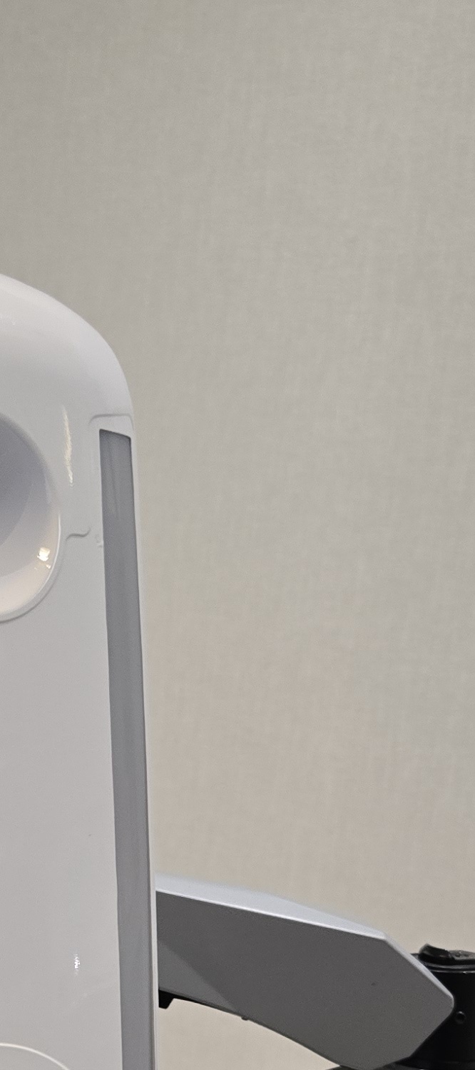 앞니 틀어짐 교정 방법 이럴때는 좀더 간단해요 관련 이미지 12