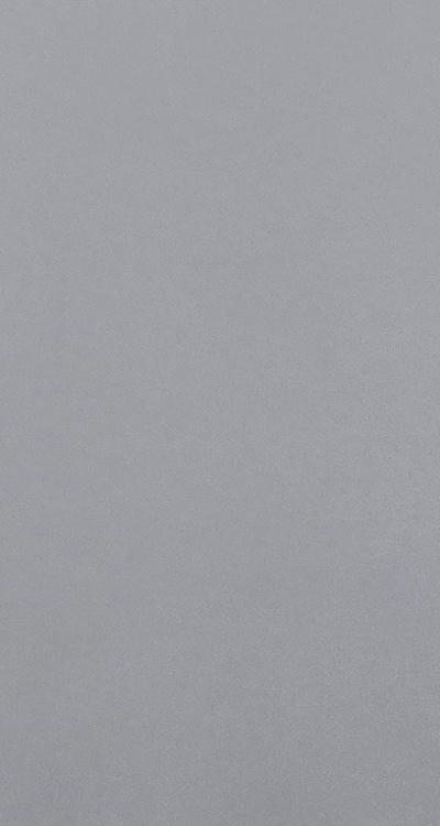 앞니 부분 교정 간단하니까 좋은건가요 관련 이미지 51