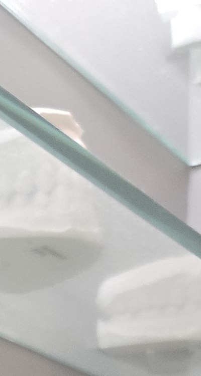 앞니 틀어짐 부분교정 얼마나 걸릴까 관련 이미지 18