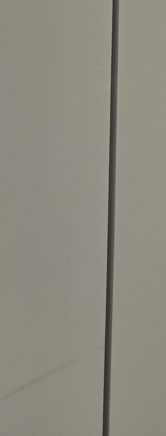 비발치 돌출입 교정 어떨때 적절할까 관련 이미지 31