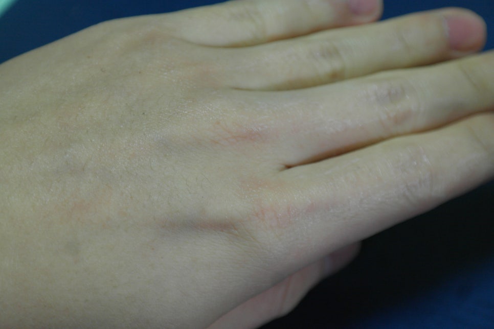 천연에센스 식물성 아카시아 콜라겐으로 깔끔하게! 관련 이미지 8