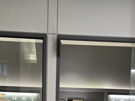 65세이상 임플란트 개수 구체적으로 체크하려면 관련 이미지 11