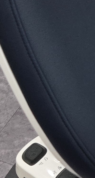 치아 사이 벌어짐 심해지는 이유부터 알아보면 관련 이미지 31