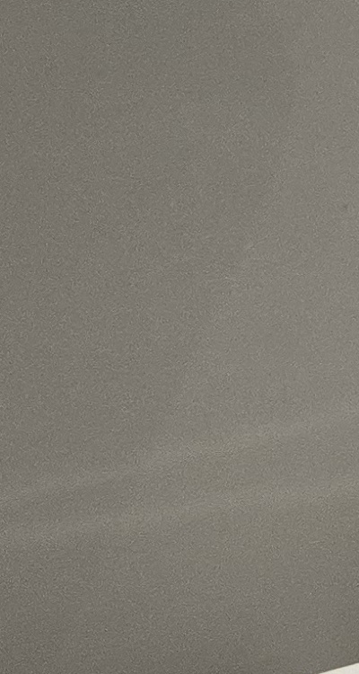 앞니 틀어짐 부분교정 얼마나 걸릴까 관련 이미지 33