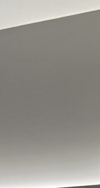 아래 사랑니 발치 통증 미리 알고 대처하려면 관련 이미지 14