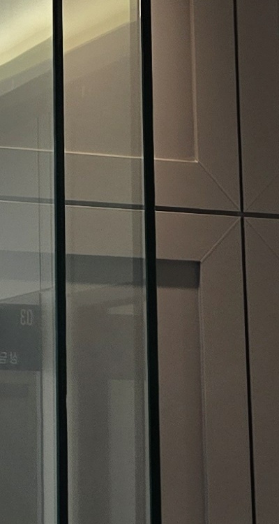 반대교합 치아교정 해결 가능할까 관련 이미지 33