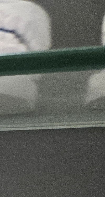 윗니 전체 임플란트 뭐부터 해야할까 관련 이미지 19