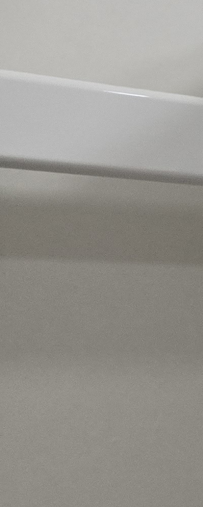 인레이 치료 후 신경치료 이유가 궁금하다면 관련 이미지 23