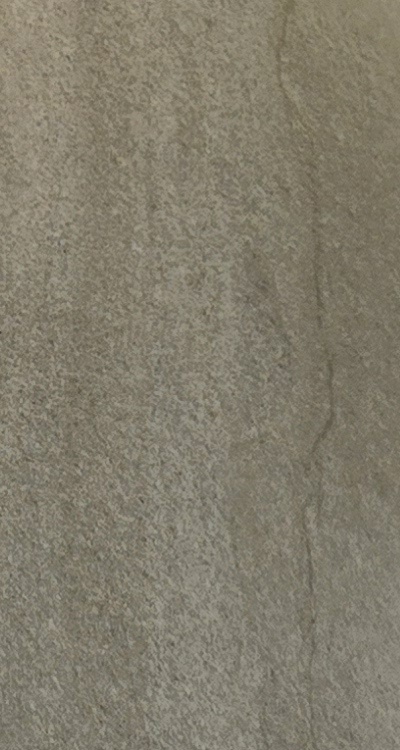 앞니 신경치료 크라운 까지 해야할 상황이라면 관련 이미지 15