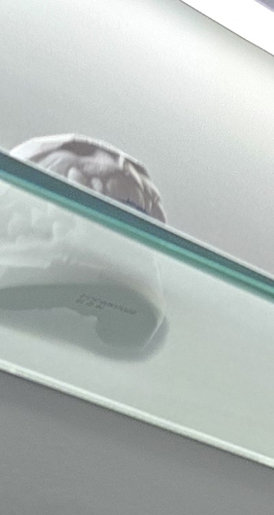 완전매복사랑니 발치 대학병원 꼭 가야하나요 관련 이미지 12