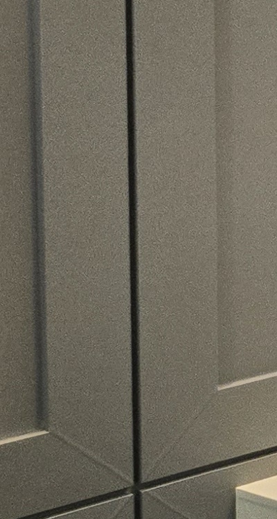 아래 사랑니 발치 통증 미리 알고 대처하려면 관련 이미지 29