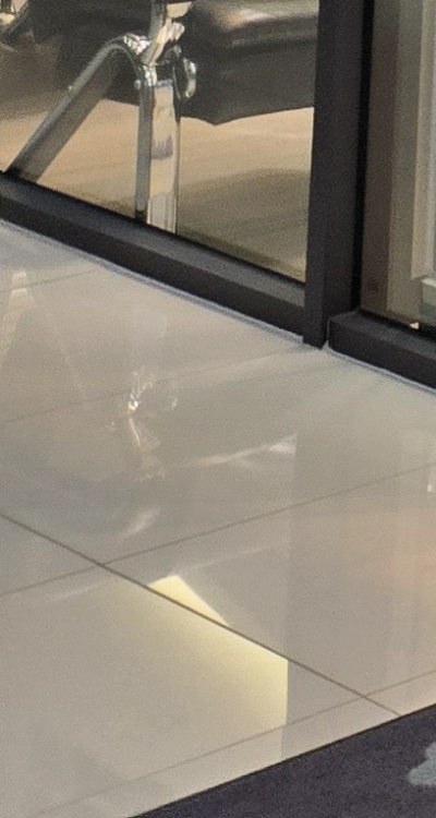 치아 발치 후 임플란트 언제부터 준비할까 관련 이미지 43