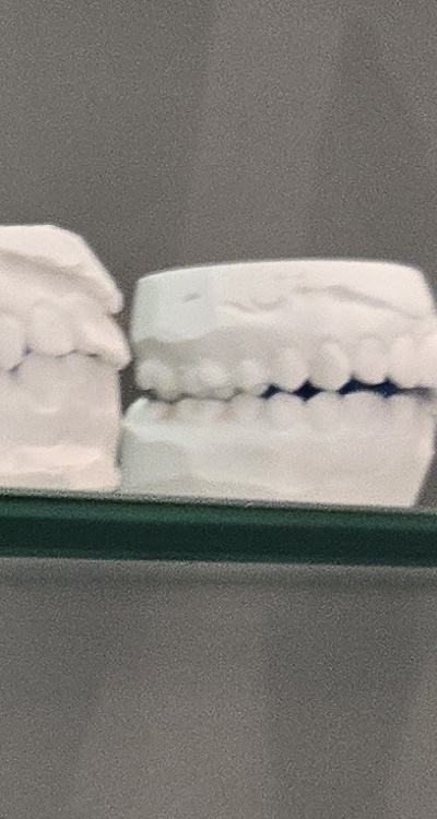 사랑니 주변 잇몸 통증 지금부터가 중요하니까 관련 이미지 28