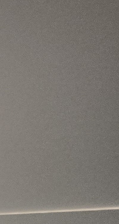 완전매복사랑니 발치 대학병원 꼭 가야하나요 관련 이미지 28