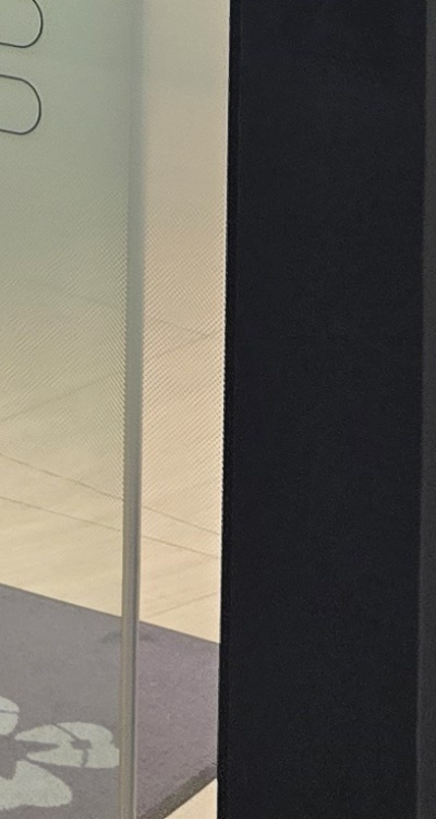 치아 발치 후 임플란트 언제부터 준비할까 관련 이미지 48