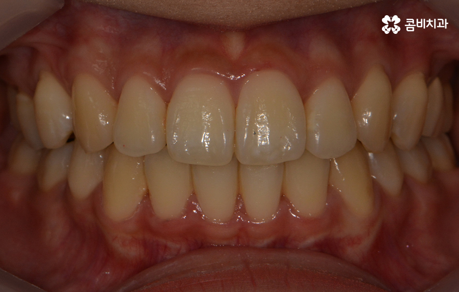 콤비교정 나에게 적합한지 판단하려면 관련 이미지 14