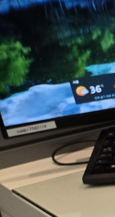 신경치료 아픈가요 망설이시는 분들이라면 관련 이미지 21