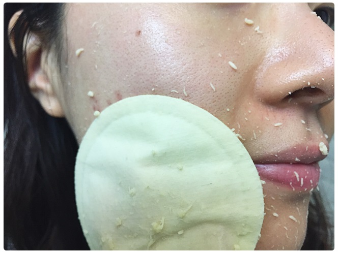 피지제거기 자극없이 뽑아 관련 이미지 5