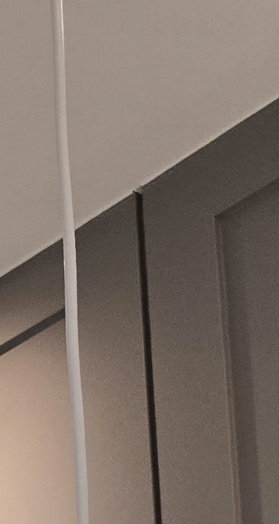 인레이 치료 후 통증 자꾸 심해지는데 괜찮은걸까 관련 이미지 18