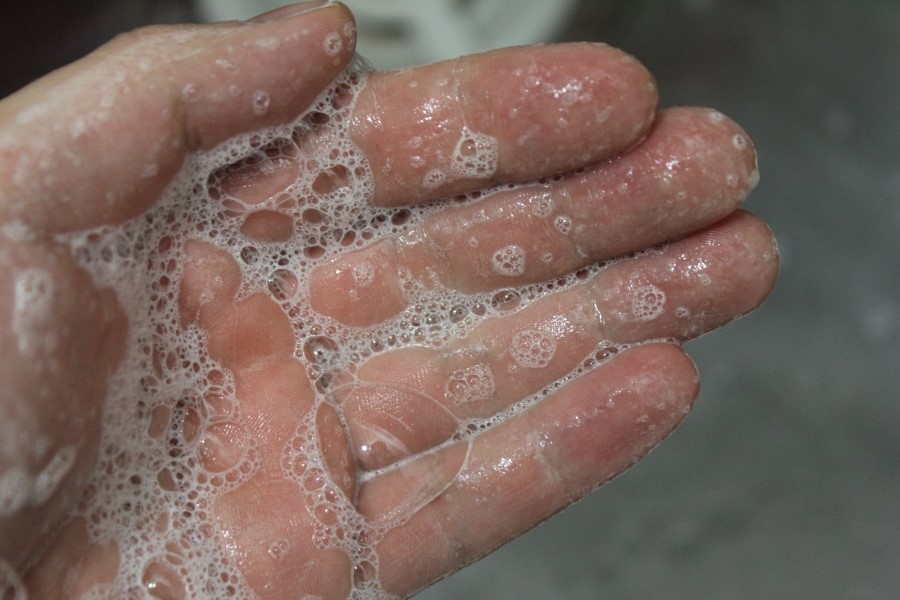 비듬샴푸추천 두피가 건강해지는 테라피션 릴렉싱 샴푸 관련 이미지 15