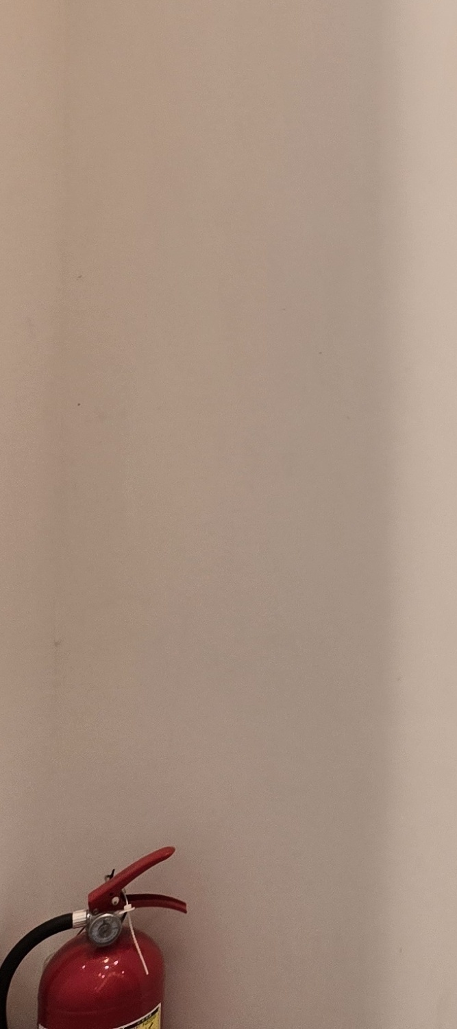 어금니 임플란트 과정 기간 어느정도 예상되나요 관련 이미지 31