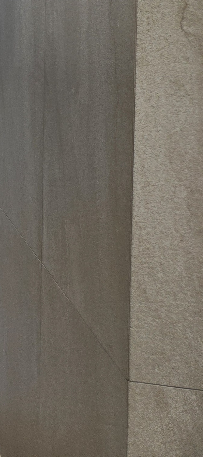 앞니 틀어짐 교정 방법 이럴때는 좀더 간단해요 관련 이미지 32