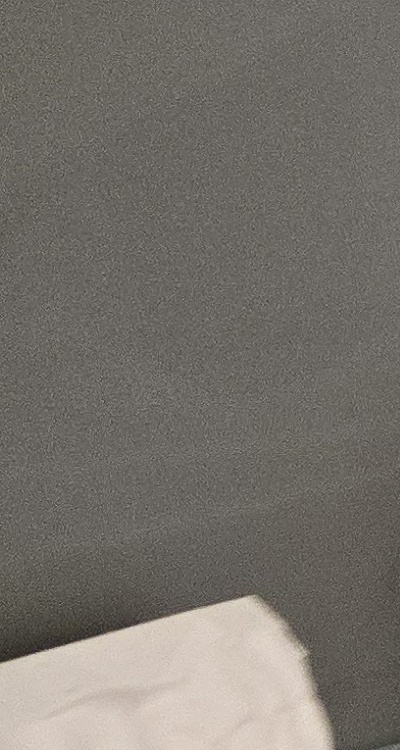 사랑니 주변 잇몸 통증 지금부터가 중요하니까 관련 이미지 34