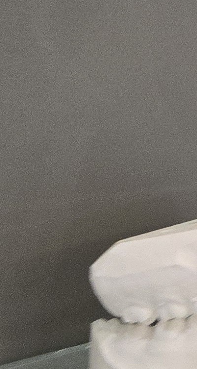 사랑니 주변 잇몸 통증 지금부터가 중요하니까 관련 이미지 35