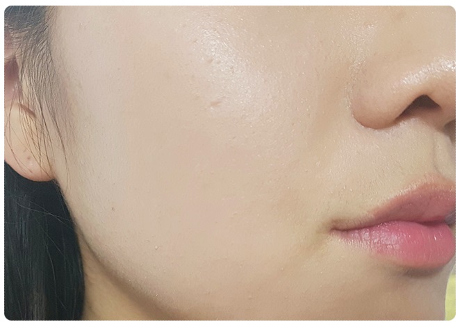 얼굴각질제거제추천 왜이제야왔니 관련 이미지 5