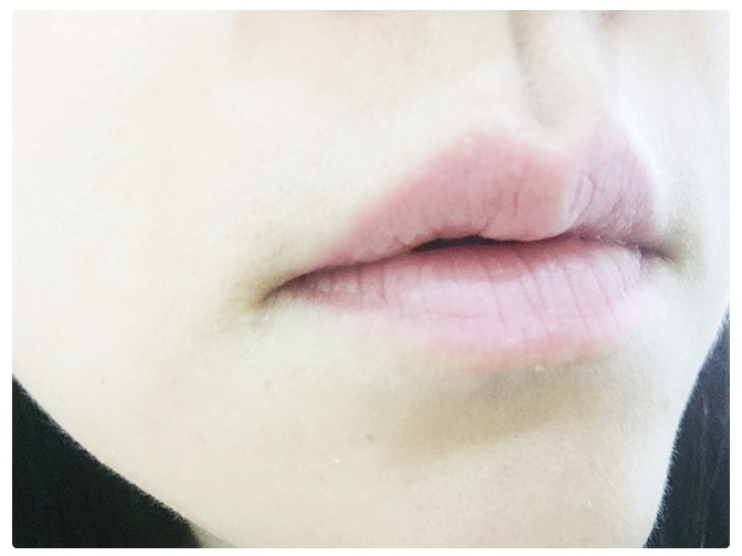 여드름화장품 새로 나온 클렌징패드 써봐! 관련 이미지 8