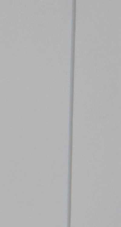 앞니 부분 교정 간단하니까 좋은건가요 관련 이미지 20