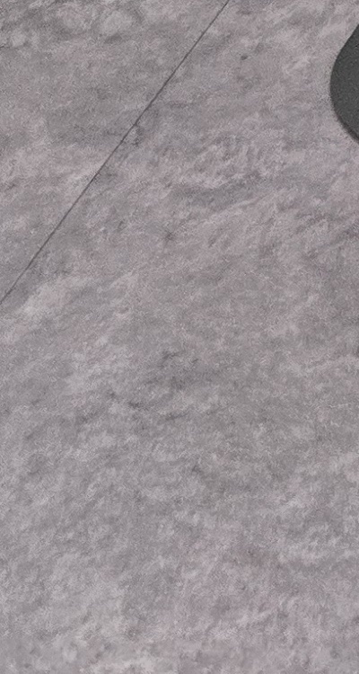 치아 사이 벌어짐 심해지는 이유부터 알아보면 관련 이미지 40