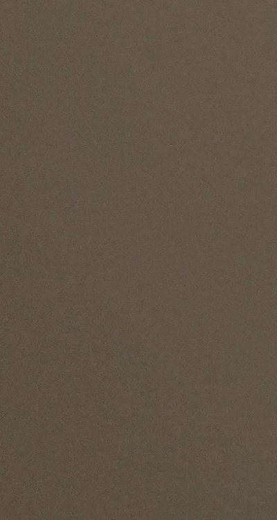 아말감 교체 레진 인레이 어떻게 대처하면 될까 관련 이미지 32