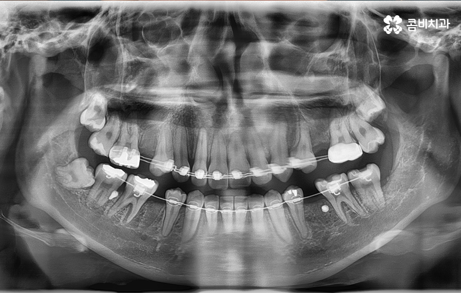 콤비교정 나에게 적합한지 판단하려면 관련 이미지 10