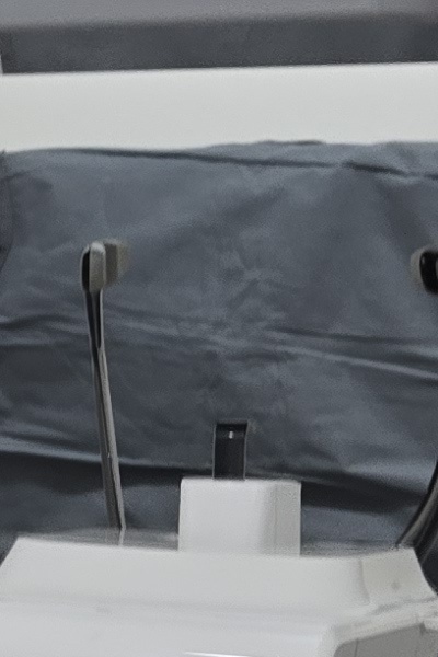 부정교합 교정 안하면 생기는 문제는 뭔가요 관련 이미지 35