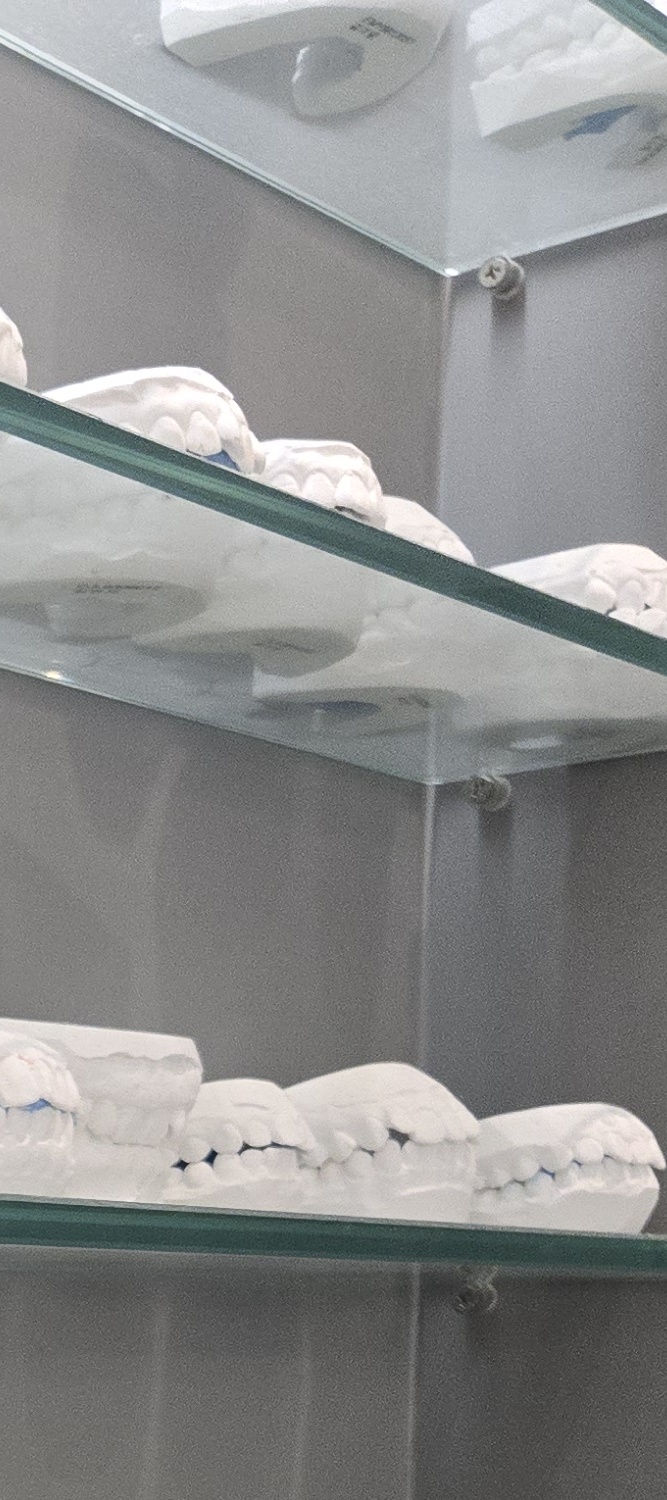 윗니만 교정 간단하게 끝내려면 관련 이미지 30