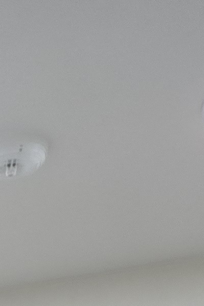 부정교합 교정 안하면 생기는 문제는 뭔가요 관련 이미지 16