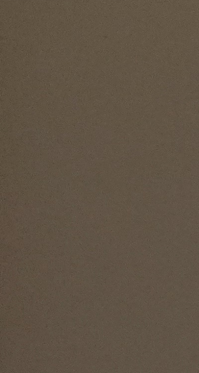 아말감 교체 레진 인레이 어떻게 대처하면 될까 관련 이미지 21