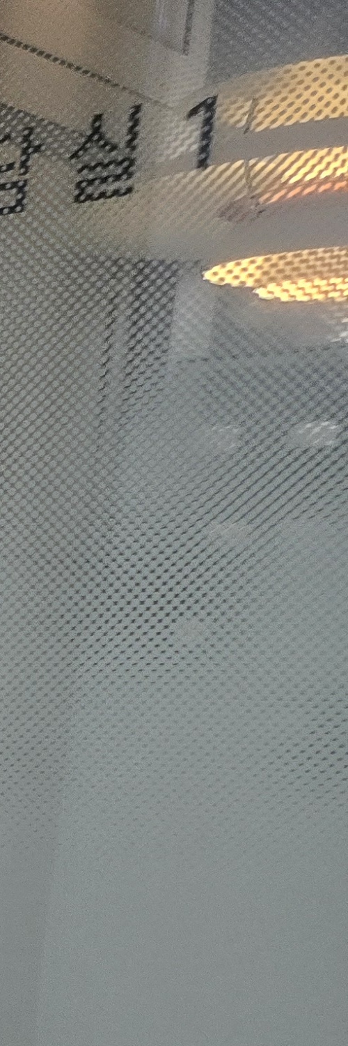 부분매복 사랑니 발치 신중하게 대비하려면 관련 이미지 14