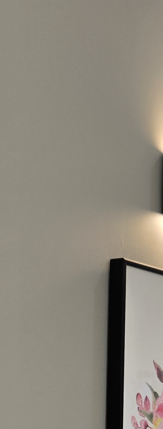 비발치 돌출입 교정 어떨때 적절할까 관련 이미지 25