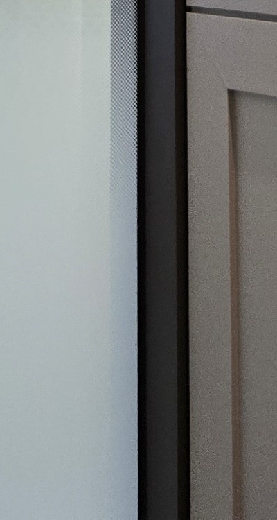 인레이 치료 후 통증 자꾸 심해지는데 괜찮은걸까 관련 이미지 46