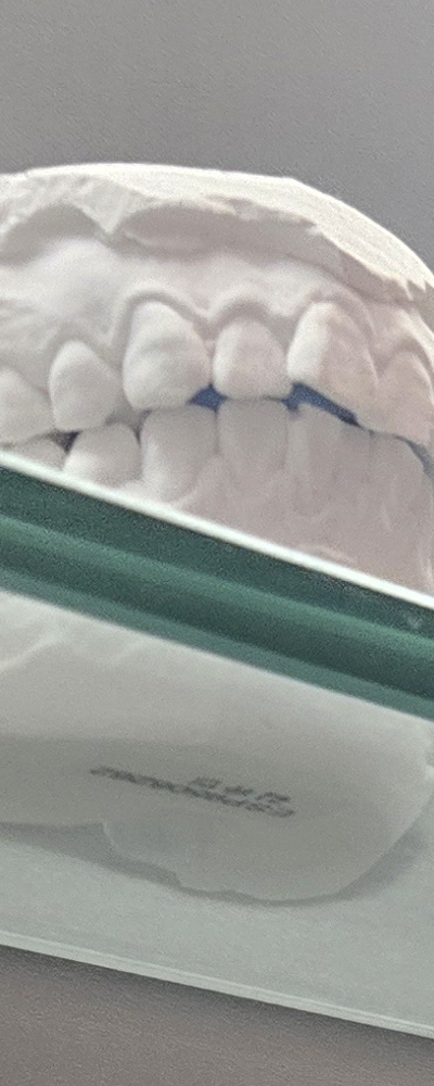 어르신 임플란트 지원 현명하게 활용하려면 관련 이미지 16