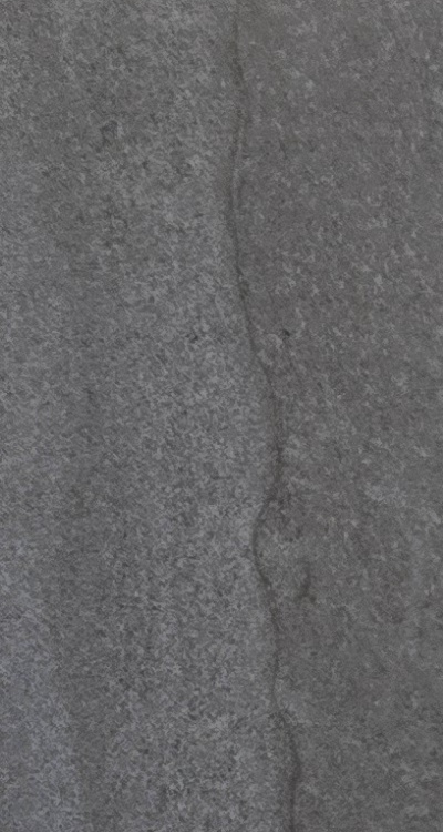 임플란트의 장점 할까 말까 고민이신 분들을 위한 정리 관련 이미지 21