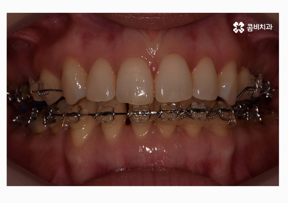 콤비교정 합리적으로 판단하려면 관련 이미지 12