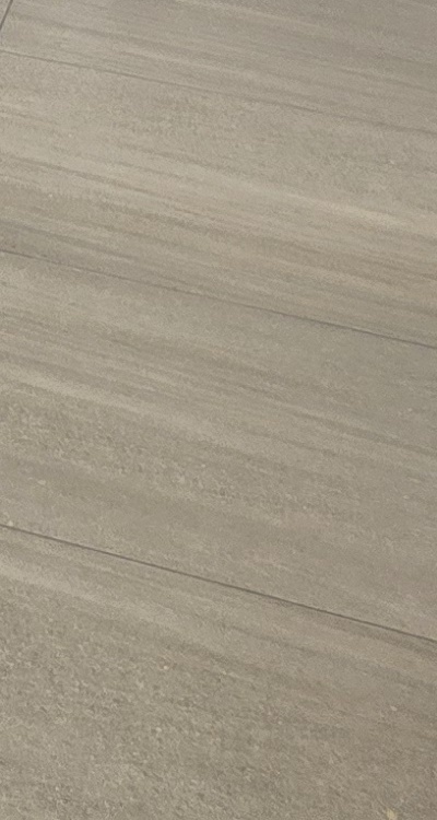 임플란트의 장점 할까 말까 고민이신 분들을 위한 정리 관련 이미지 48