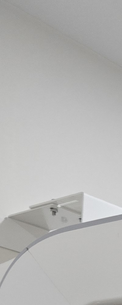 인레이 치료 후 신경치료 이유가 궁금하다면 관련 이미지 15