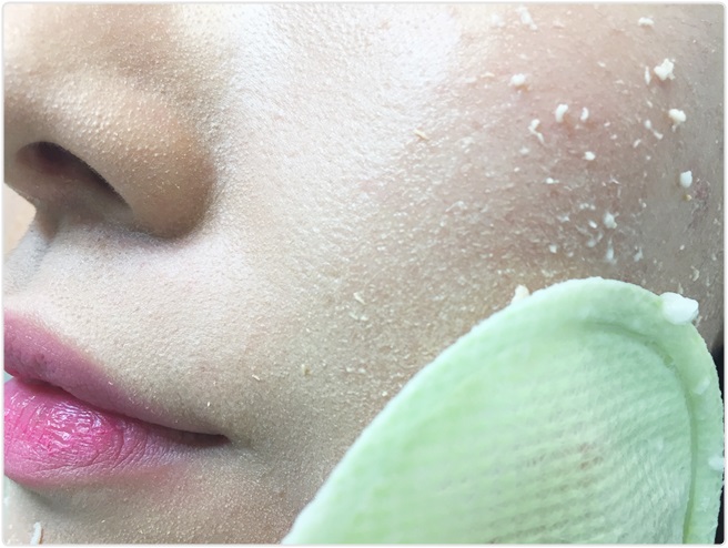 환절기 피부트러블 집에서 간편하게! 관련 이미지 7