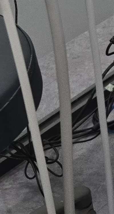 어금니 임플란트 안하면 후회하게 되는걸까 관련 이미지 35