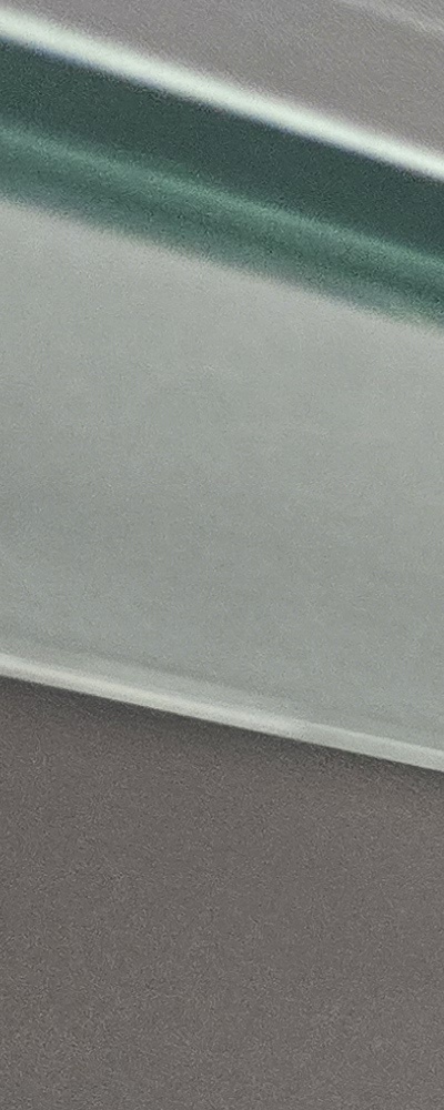 어르신 임플란트 지원 현명하게 활용하려면 관련 이미지 13