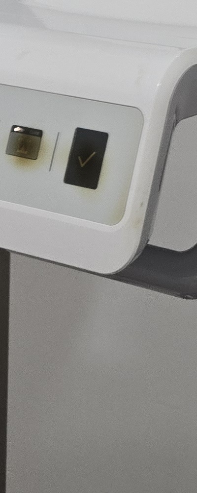 인레이 치료 후 신경치료 이유가 궁금하다면 관련 이미지 37